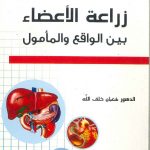 زراعة الأعضاء بين الواقع والمأمول